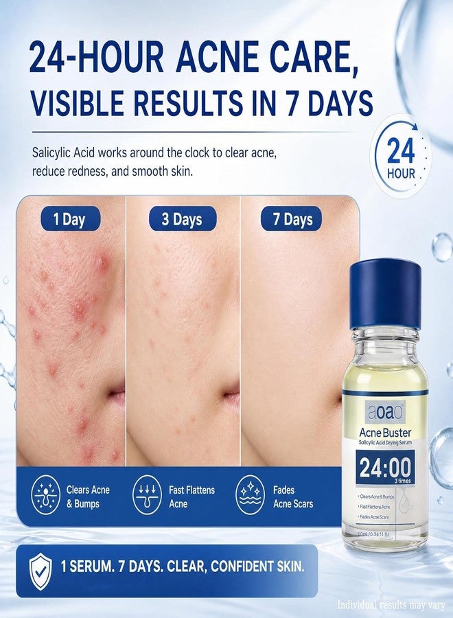 AOAO Salicylic Acid Acne Serum, Acne Drying Lotion for Acne-Prone Sensitive Skin, Shrinks Pimples Overnight, Fade Acne Marks, 20% Zinc Oxide Medicated Spot Treatment for Pimples and Blemishes, 0.34 fl oz - Image 4