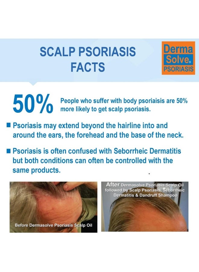 Dermasolve Scalp Psoriasis Medicated Shampoo & Conditioner - 8 oz bottles (2 Pack) - Image 2