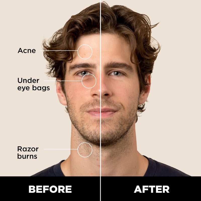 Stryx Concealer Stick Tool for Men, Light Cognac - Natural Pigments Hides Imperfections, Acne, Razor Burns, Scars, & Rosacea - Highly Adaptable Shades for Easy, Undetectable Coverage - All Skin Tones - Image 2