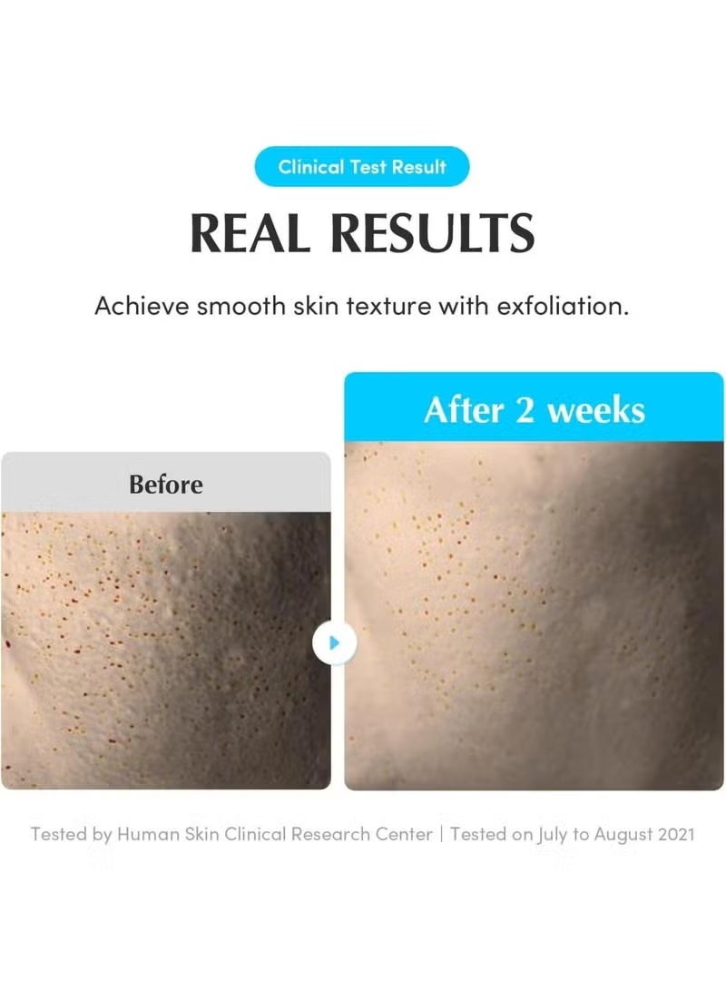 إيكوالبيري تونر حمام السباحة من إكوالبيري - تونر مقشر لطيف مع إنزيم طبيعي وحمض الهيالورونيك، للبشرة الحساسة | منتجات العناية بالبشرة الكورية، 300 مل / 10.14 أونصة سائلة - Image 4