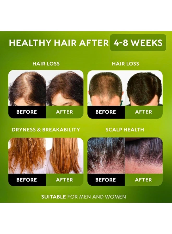 EELHOE Batana Oil Organic Hair Cream - 100% Natural Batana Oil for Hair Growth, Prevent Hair Loss, Eliminate Split Ends, Repair Damaged Hair, Honduras Raw Botana Oil Hair Growth Thick Cream for Women & Men - Image 2