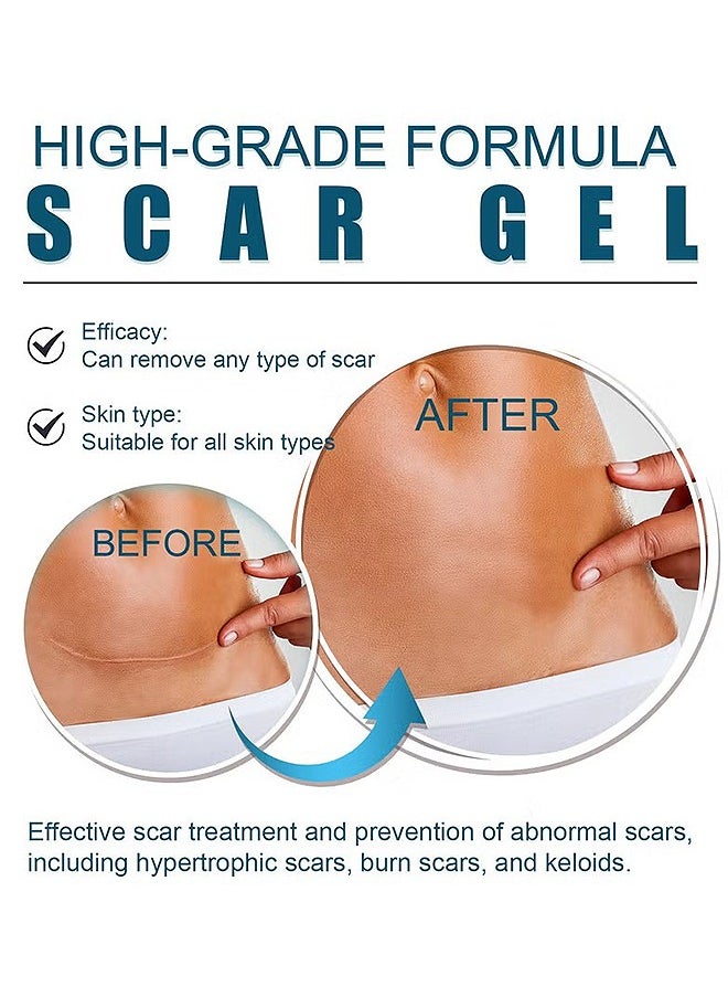 West&Month - Silicone Scar Removal Gel, Hight Quality Scar Removal Gel, Acne Scar Treatment, Deep Acne Scar Removal, Burns Keloids Hypertrophic, Repair Damaged Skin, Removing Acne Marks Scar Repair Cream ﻿ - Image 1