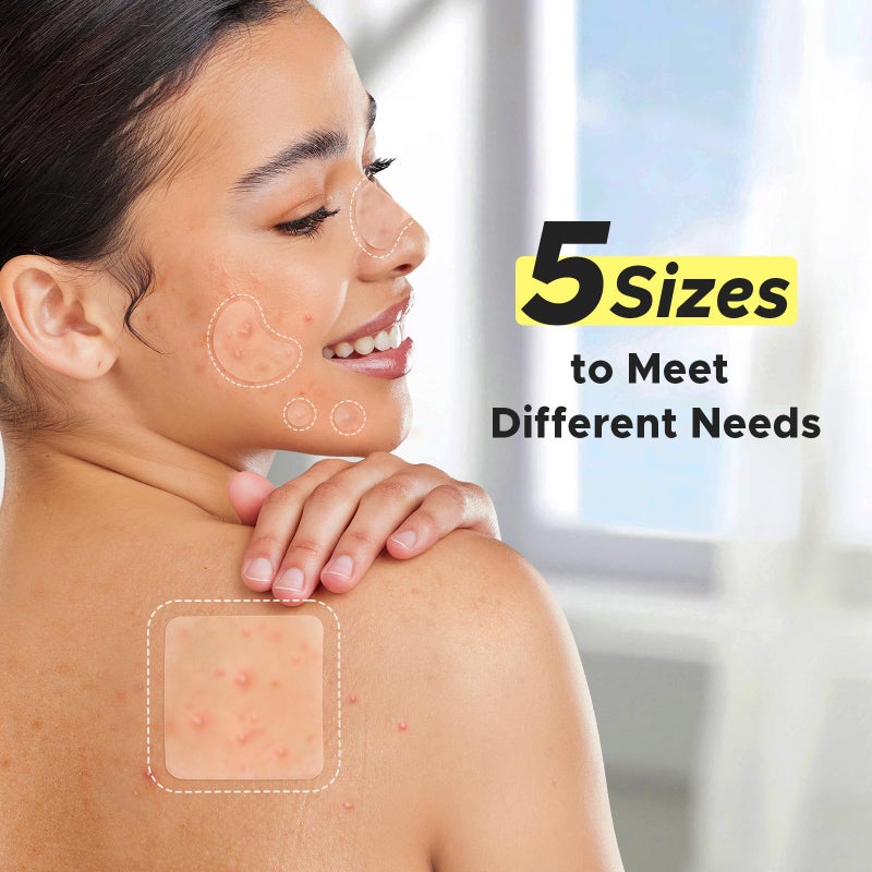 LitBear Pimple Patches for Face, Large Acne Patch, XL Hydrocolloid Bandages,Zit Stickers for Forehead, Chin, Nose, Body, Back, and Chest (5 Sizes, 228 Pimple Patches) - Image 3