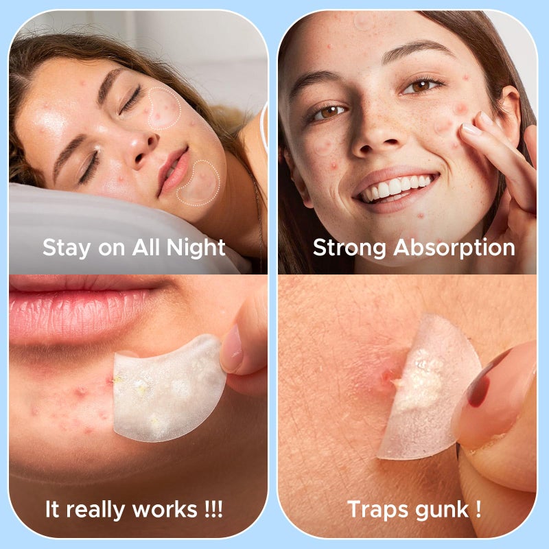 LitBear Pimple Patches for Face, Large Acne Patch, XL Hydrocolloid Bandages,Zit Stickers for Forehead, Chin, Nose, Body, Back, and Chest (5 Sizes, 228 Pimple Patches) - Image 4
