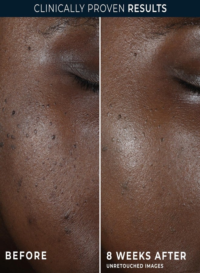 RoC Multi Correxion 5 in 1 Restoring/Anti Aging Facial Night Cream with Hexinol, 1.7 Ounces (Packaging May Vary) - Image 5