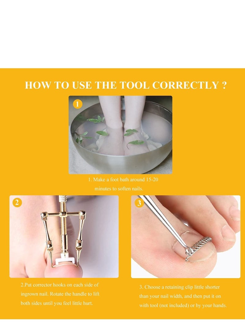 SYOSI Ingrown Toenail Treatment Kit with 12 Toenail Braces, Pure Copper Ingrown Toenail Lifter, Steel Foot Care Tool for Paronychia - Image 2