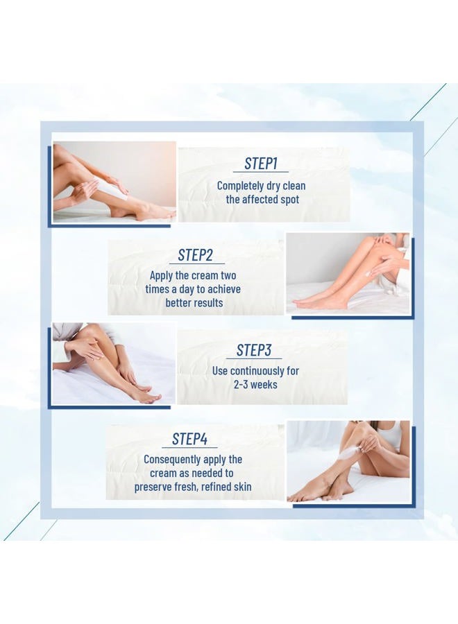 OUKEYA Urea Cream 40 Percent,Foot & Hand Cream for Dry Cracked,Urea Lotion for Feet Maximum Strength(4 Packs) - Image 4