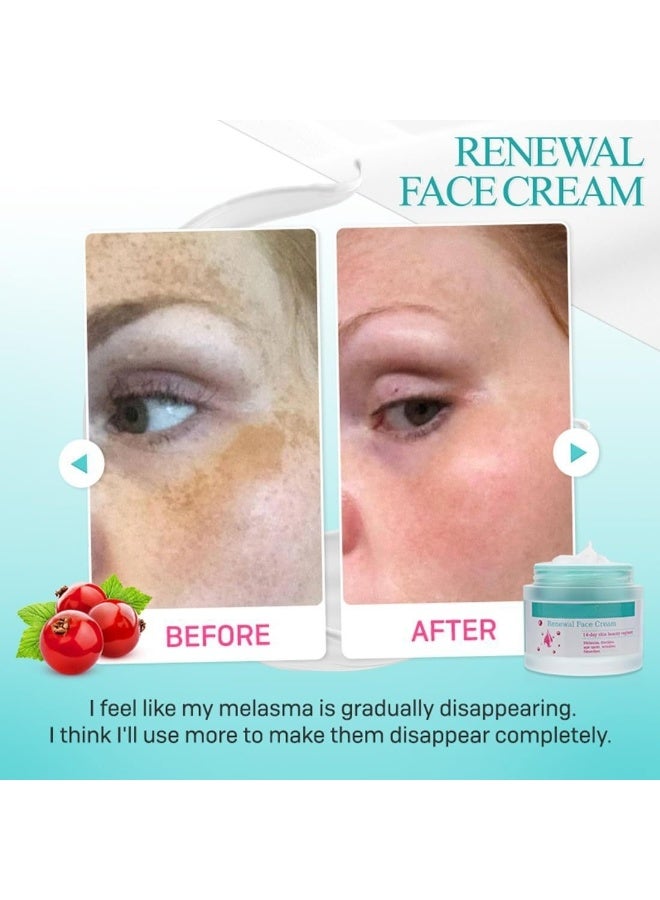 Saam Crafts Face Cream，Saam -Crafts Cosmetics Cream Dark Spots Cream,Saam Renewal Face Cream for Melasma and Freckles Treatment for All Skin Types,Anti-wrinkle Face Cream,Korean Saam -Crafts Renewal Face Cream -50g - Image 4