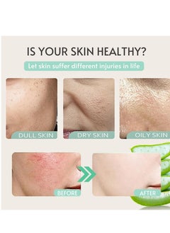 KOEC Organic Aloe Vera Cream, Aloe Vera Moisturiser Face Cream with Vitamin E, Relieve Irritated Skin Caused by Sunburn, Rashes, All Skin Type 150ml  - Image 5