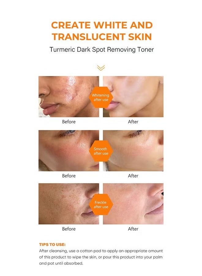 MOOYAM Turmeric Dark Spot Corrector Toner 100ML Facial Toner For Acne Prone Skin Dark Spot Remover For Face Hydrating Face Toner For Women Treatment 100ml  - Image 4