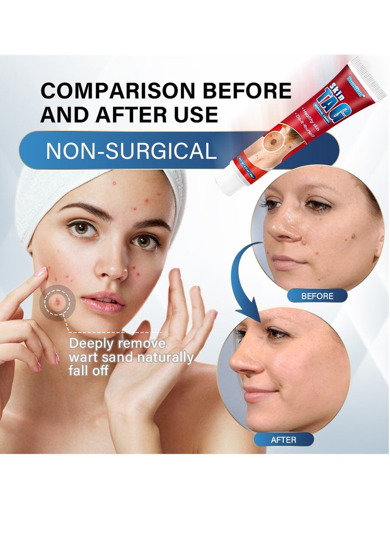 Sumifun Skin Tag Removal Cream,Remove Warts,Remove Moles and Smooth Skin, Skin Tag for Common Treatment Effective and Safe 20g  - Image 4