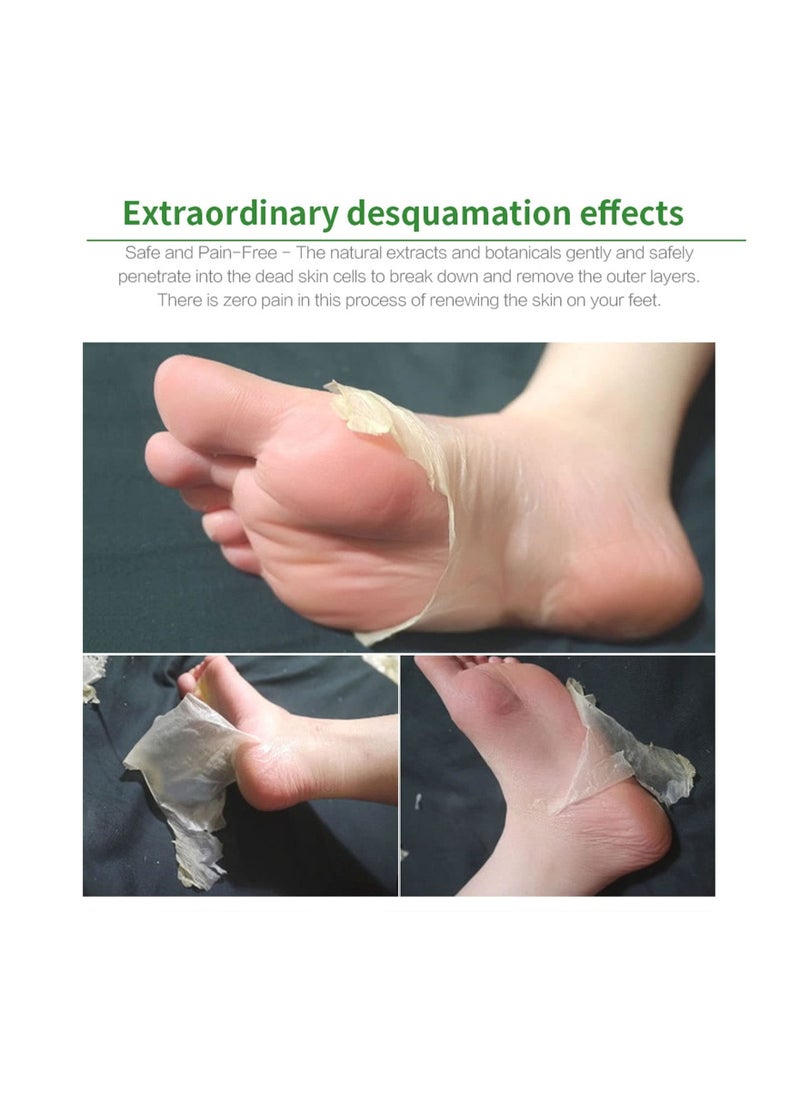 Y&D - Foot Peel Mask Natural Aloe Vera Gel Mask for Hard Skin Exfoliating Feet Peeling Socks Callus Remover Care Skin Women Men (Aloe Vera)(3Pcs) - Image 1