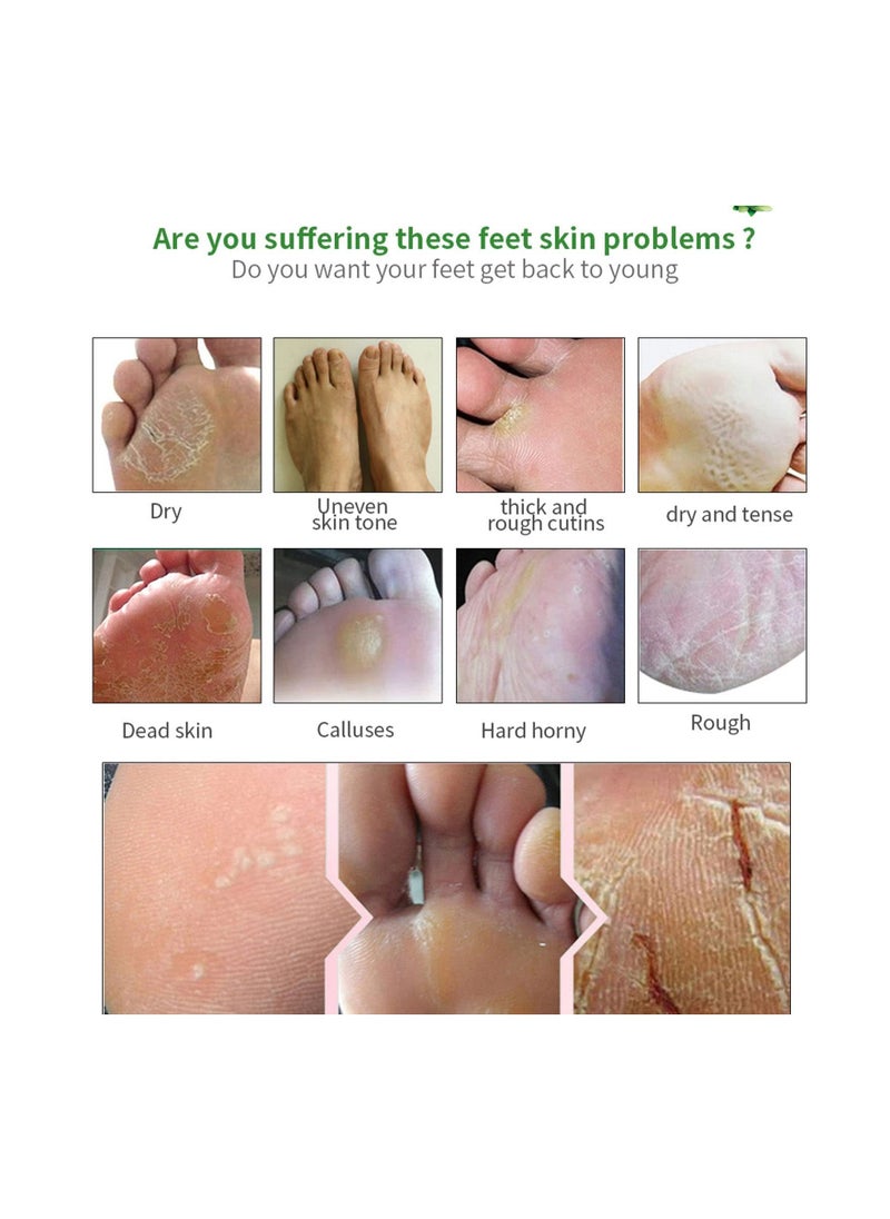 Y&D - Foot Peel Mask Natural Aloe Vera Gel Mask for Hard Skin Exfoliating Feet Peeling Socks Callus Remover Care Skin Women Men (Aloe Vera)(3Pcs) - Image 1