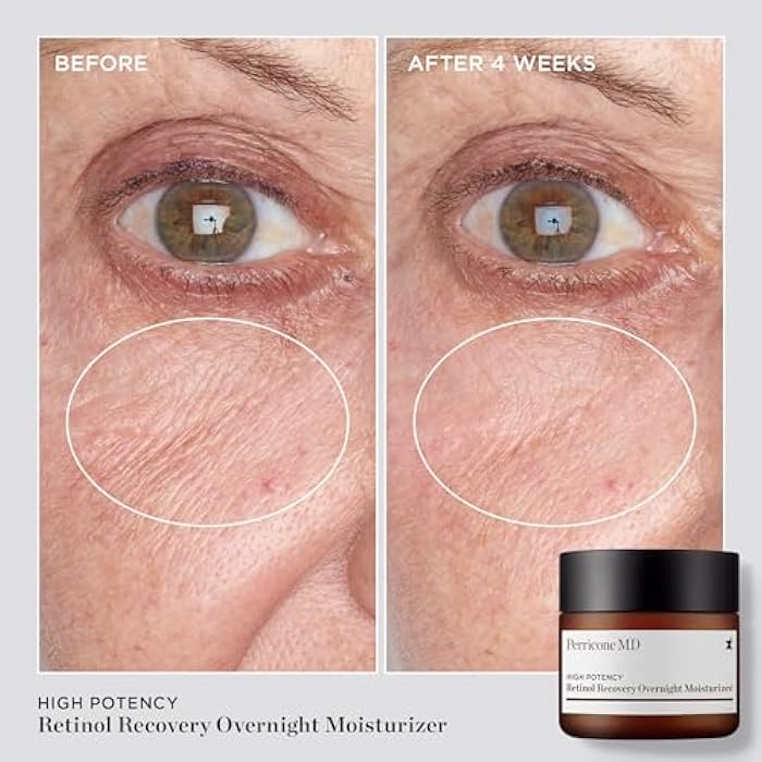 Perricone MD High Potency Classics Retinol Recovery Overnight Moisturizer - Image 4