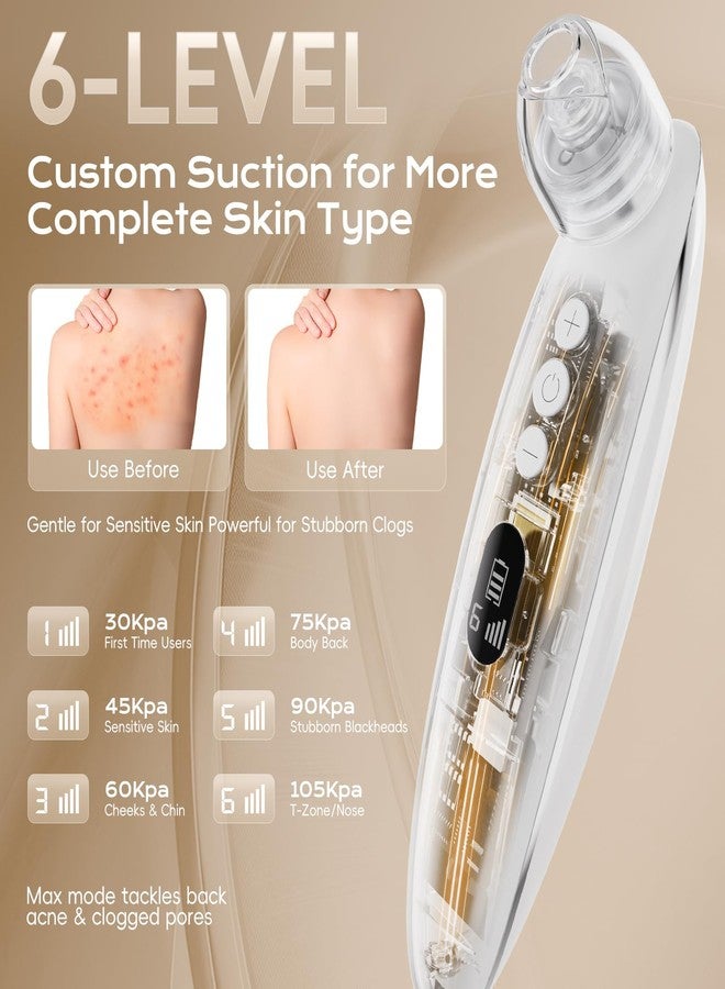 Yolampan Facial Pore Blackhead Remover Vacuum Blackhead Extractor Face Scraper Cleansing Tool Sucker Rechargeable Pore Cleaner Kit for Women Men with 6 Adjustable Suction Levels, 4 Probes (White) - Image 3