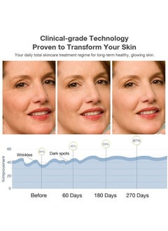 NEWKEY Red Light Therapy for Face Wrinkles, LED Face Mask Light Therapy, Blue&Red Light Therapy Mask for Face, Korea PDT Technology Red Light for Anti -Wrinkles 