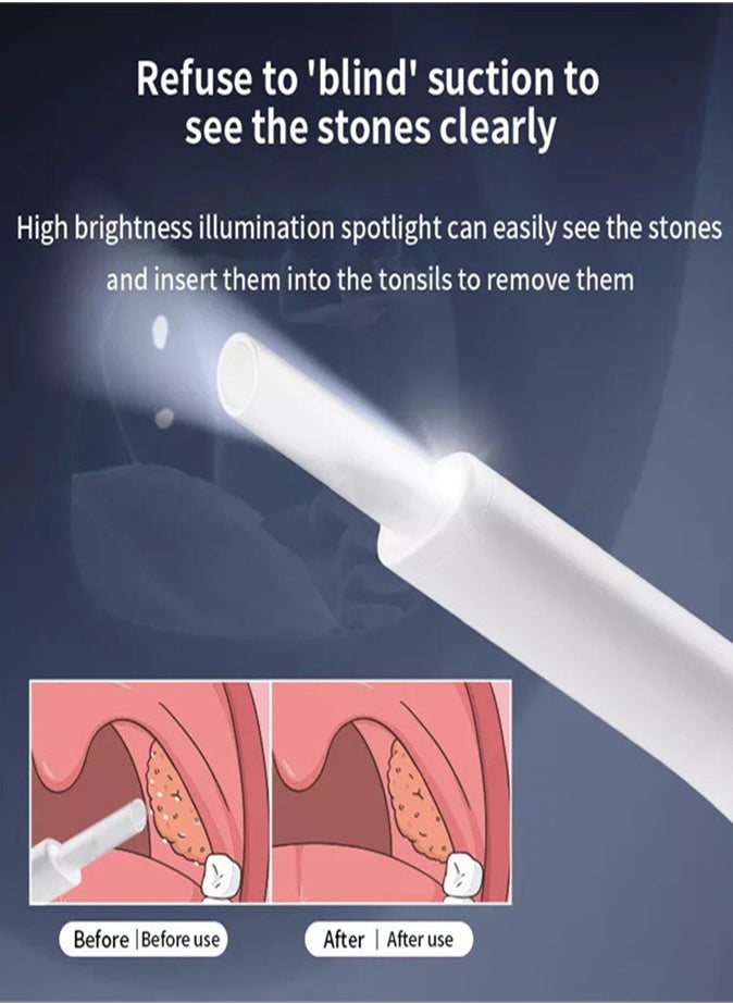 Electronic tonsil stone removal kit visualization, clear view, oral cleaning care tool