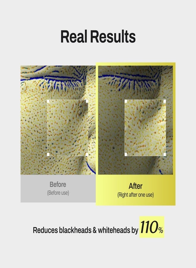 MEDITHERAPY Niacin X BHA Pore Mild Clear Toner Pad - Korean Toner Pads for Face - Hydrating Face Toner for Pore Minimizer - Exfoliating Pore Care with Dual-Sided Pads - Gentle Blackhead Remover, 60 Pads - Image 5
