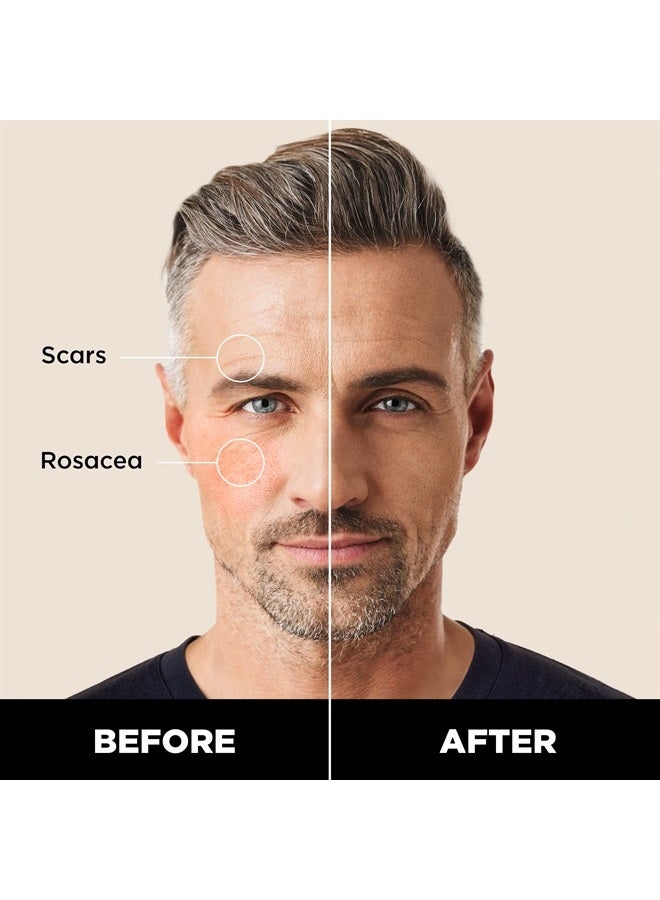 Stryx Concealer Pen Tool for Men, Light Cognac - Natural Pigments Hides Imperfections, Acne, Razor Burns, Scars, & Rosacea - Highly Adaptable Shades for Easy, Undetectable Coverage - All Skin Tones - Image 2