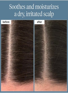 Briogeo Briogeo Scalp Revival™ Rosemary Pre-Wash Oil 100ml  - Image 3