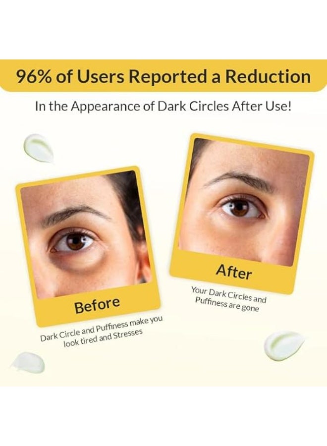 Eyecirque Under Eye Gel for Dark Circles for Women and Men | With Retinol Niacinamide Under Eye Gel to Reduce Dark Circles, Puffiness & Wrinkles - Image 3