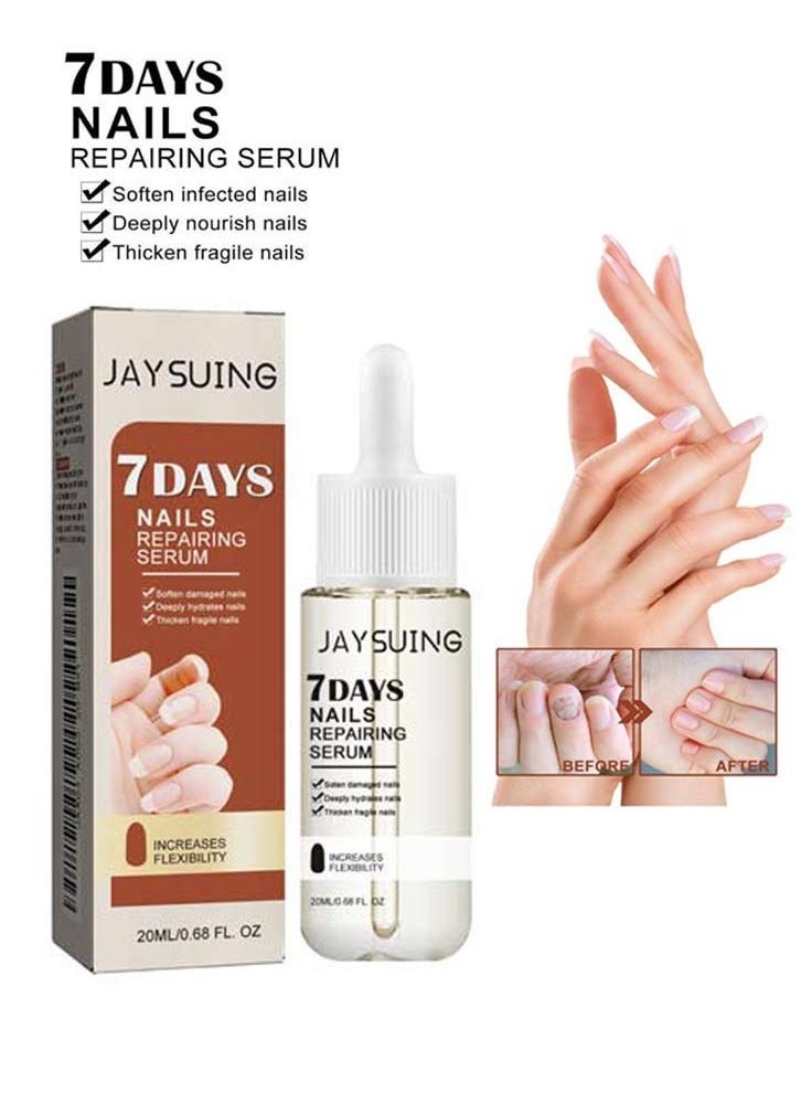 Jaysuing 7DAYS Nails Repairing Serum, Anti-Fungal/Nourishing/Strengthening Formula, Promotes Rapid Nail Growth, Hydrates Nails, Improves Nail Health, Treats Onychomycosis, Prevents Breakage - Image 1