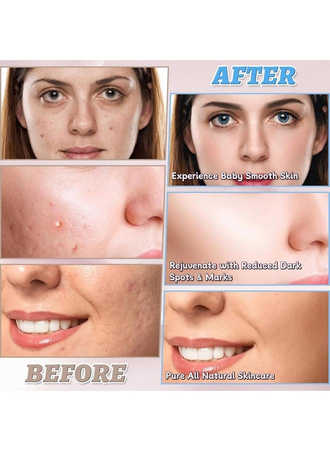 RAMPKD® Turmeric & Kojic Acid Face Cleansing Pads for Dark Spots, Skin Brightening & Acne Prevention | Vitamin C, Retinol & Chamomile Hydrolat | For Women & Men | All Skin Type | 60 Pieces Pack of 1 - Image 5