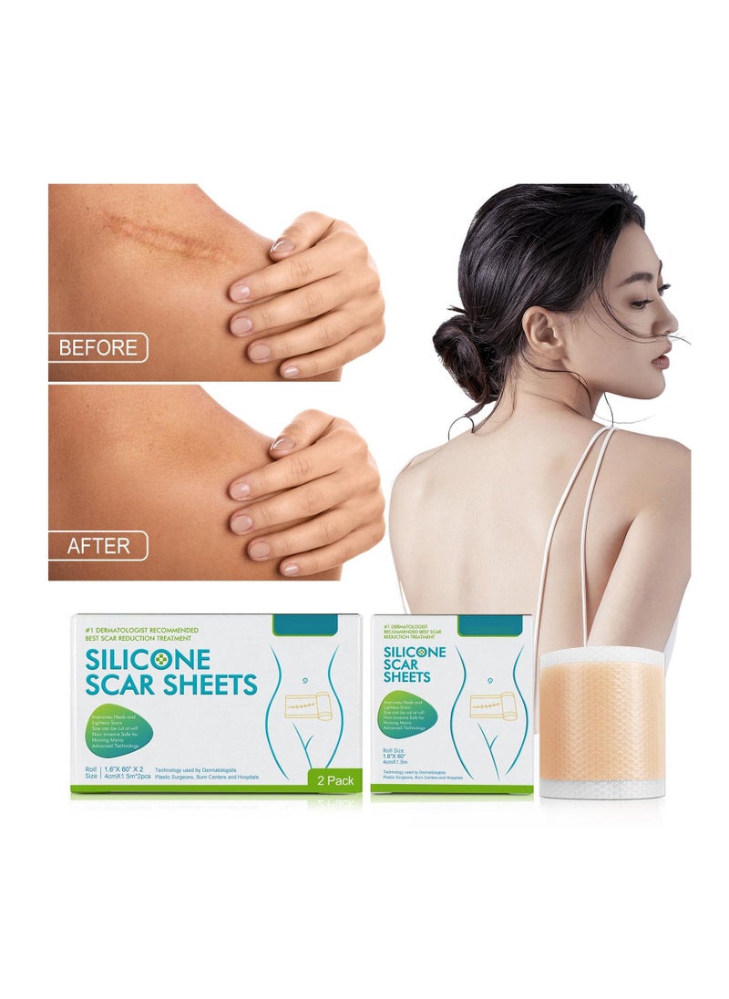 NORTH MOON Self-adhesive Repair Skin Care Beauty Sheets Silicone Scar Sheets  - Image 2