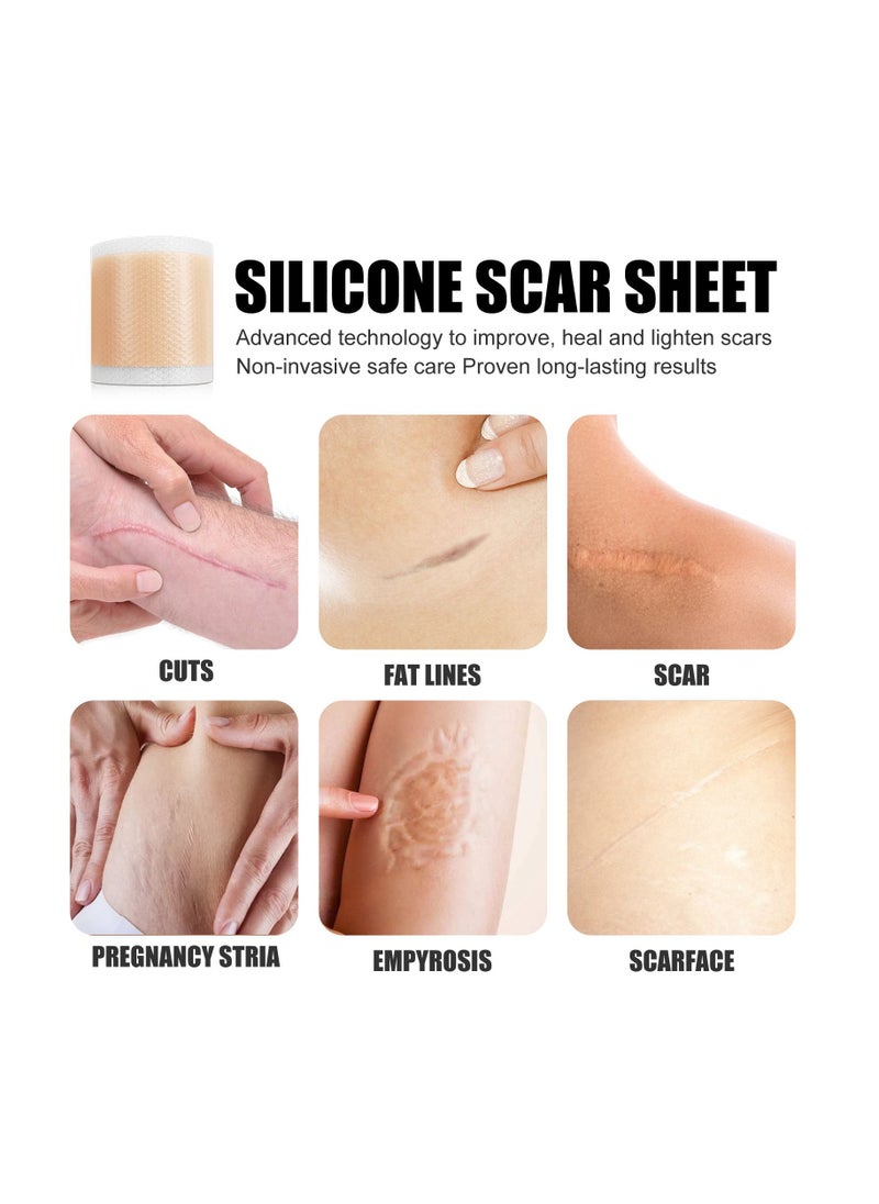 NORTH MOON Self-adhesive Repair Skin Care Beauty Sheets Silicone Scar Sheets  - Image 5