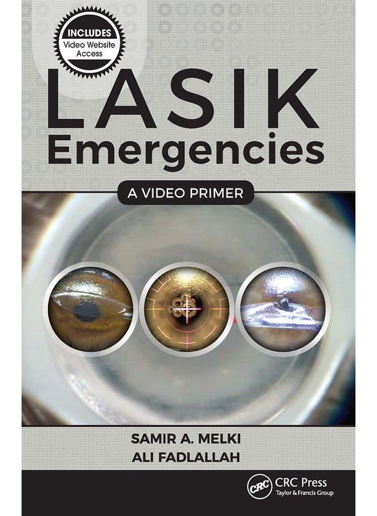 LASIK Emergencies: A Video Primer