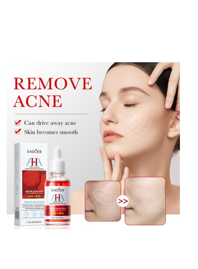 سادور AHA BHA حمض الفواكه لإزالة حب الشباب الطباعة ترطيب حب الشباب إزالة جوهر 30ML - Image 3