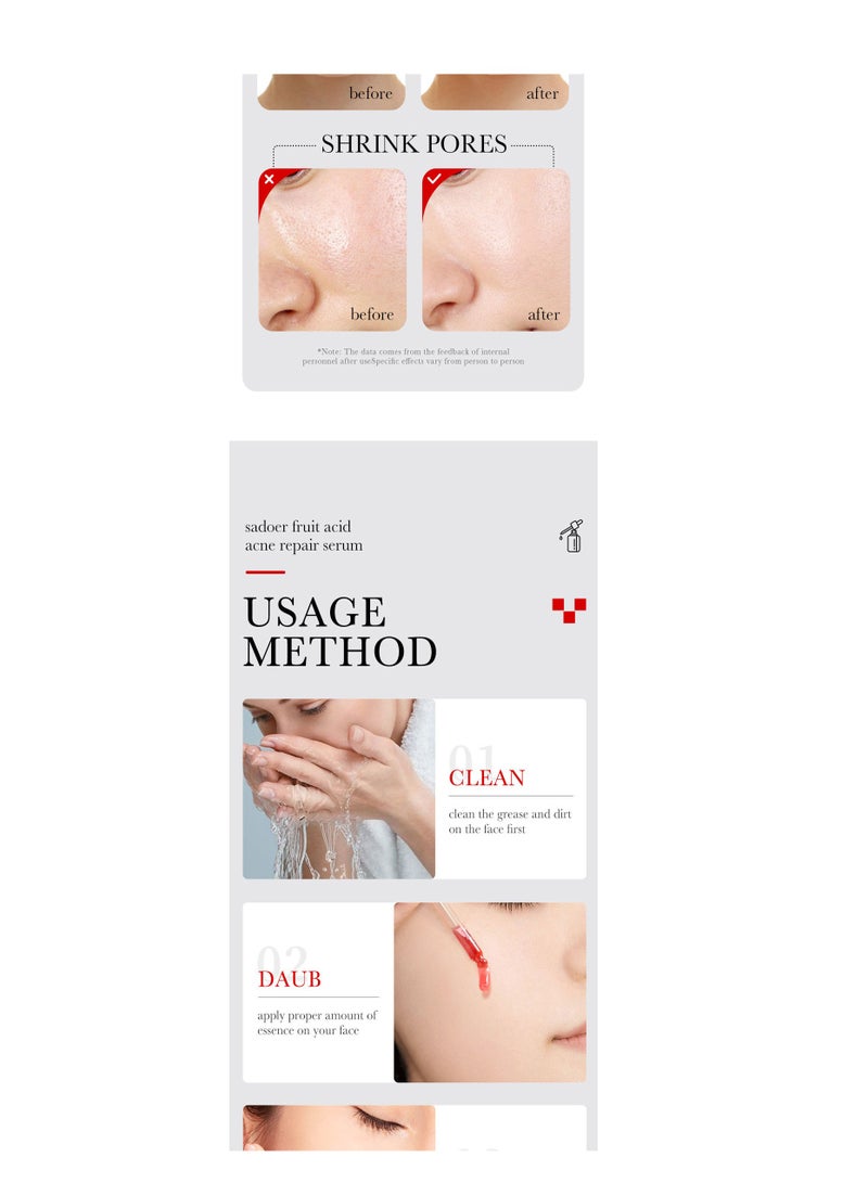 سادور AHA BHA حمض الفواكه لإزالة حب الشباب الطباعة ترطيب حب الشباب إزالة جوهر 30ML - Image 4
