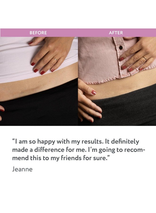 ScarAway Advanced Silicone Scar Sheets for C-Section, Reusable Strips (1.5” x 7”) for Hypertrophic and Keloid Scars from C-Section & Other Surgeries, 4 Sheets - Image 5