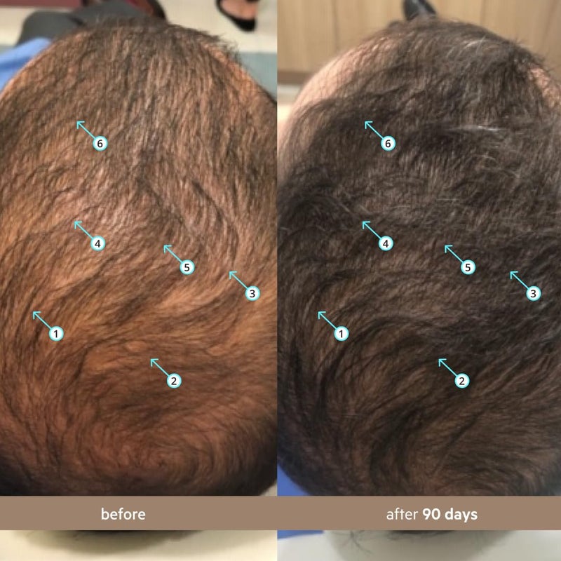 DS LABORATORIES DS Labs Spectral Menâ€™s Hair Density Serum (formerly Spectral.DNC-N), 60mL - Lightweight Leave In for Fuller Looking, Thicker Looking Hair, Fast Absorbing, Non-Greasy, For All Hair Types, (3 Pack) - Image 3