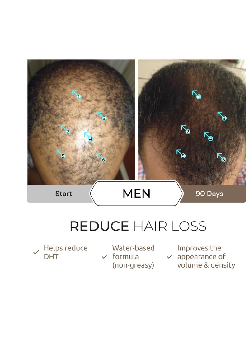 DS LABORATORIES DS Laboratories Spectral.DNC-N Hair Serum - 3 Month Supply, Hair Growth Serum, Hair Loss Treatments for Women & Men, Hair Thickening Products, Hair Growth for Men, Hair Growth Products  - Image 5