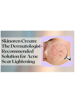 LEO SKINOREN CREAM 30g  - Image 4