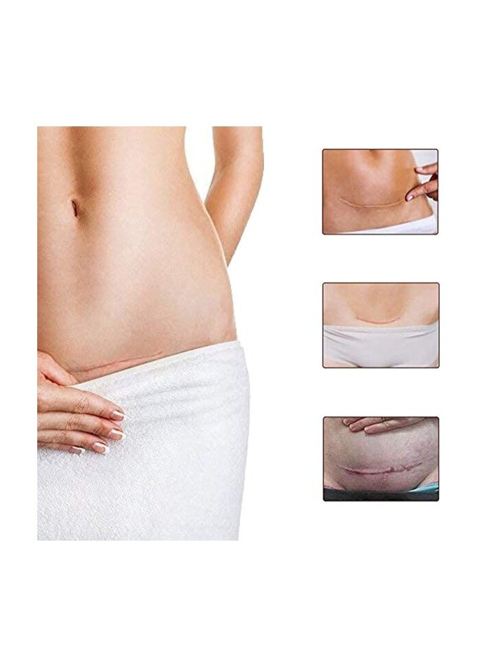 ALIVER ALIVER TCM Scar And Acne Mark Removal Gel Ointment 30g - Image 5