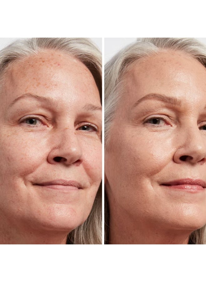 آي كوزمتيكس خافي عيوب البقع الداكنة من آي تي ​​كوزماتيكس - لون محايد فاتح 22 - Image 2