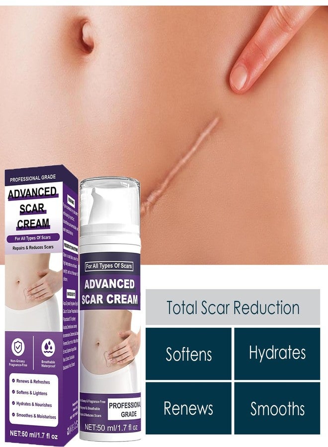 BWDETY Silicone Scar Gel,Scar Removal Cream,Advanced Scar Gel,Keloid Bump Removal,Scar Cream for Surgical Scars,Stretch Mark,C-Section,Old and New Scars (1pcs-b - Image 5