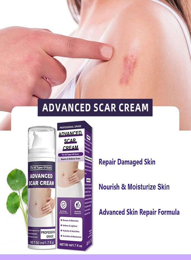 BWDETY Silicone Scar Gel,Scar Removal Cream,Advanced Scar Gel,Keloid Bump Removal,Scar Cream for Surgical Scars,Stretch Mark,C-Section,Old and New Scars (1pcs-b - Image 4