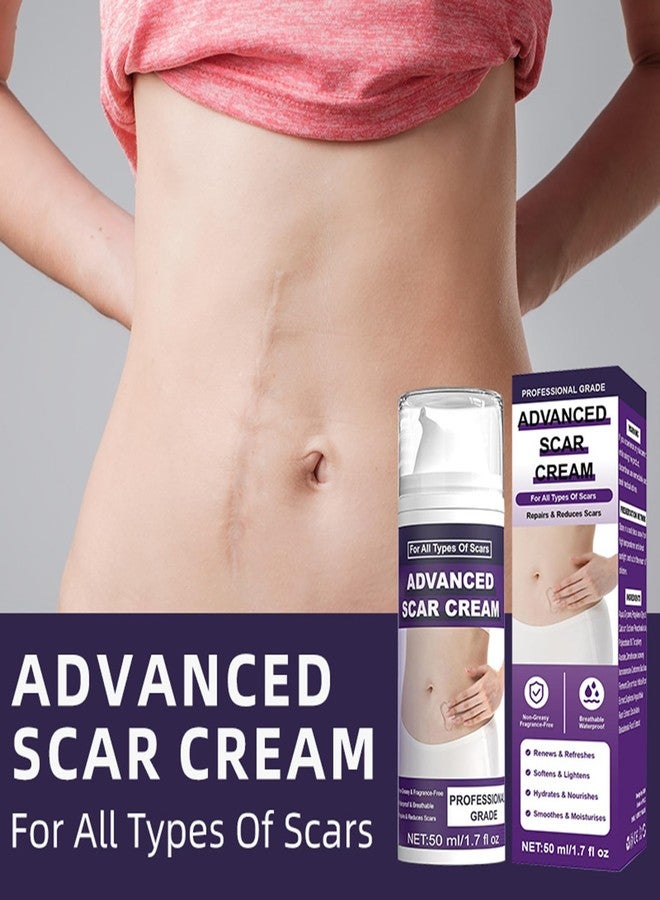 BWDETY Silicone Scar Gel,Scar Removal Cream,Advanced Scar Gel,Keloid Bump Removal,Scar Cream for Surgical Scars,Stretch Mark,C-Section,Old and New Scars (1pcs-b - Image 3