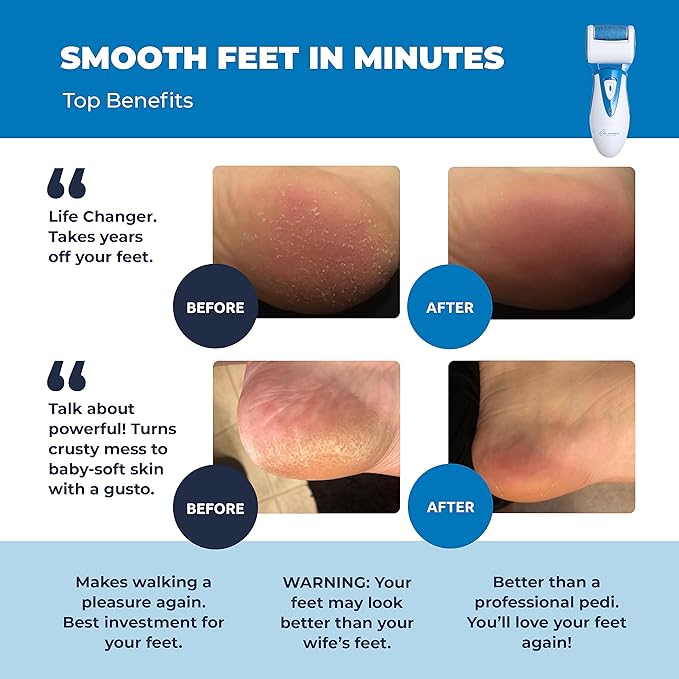 Own Harmony Electric Hard Skin Remover for Men by Own Harmony Callus Remover Rechargeable Pedicure Tools w 3 Coarse Rollers VelvetSmooth Foot Care Professional Spa Pedi Feet File USB Cord - Image 2