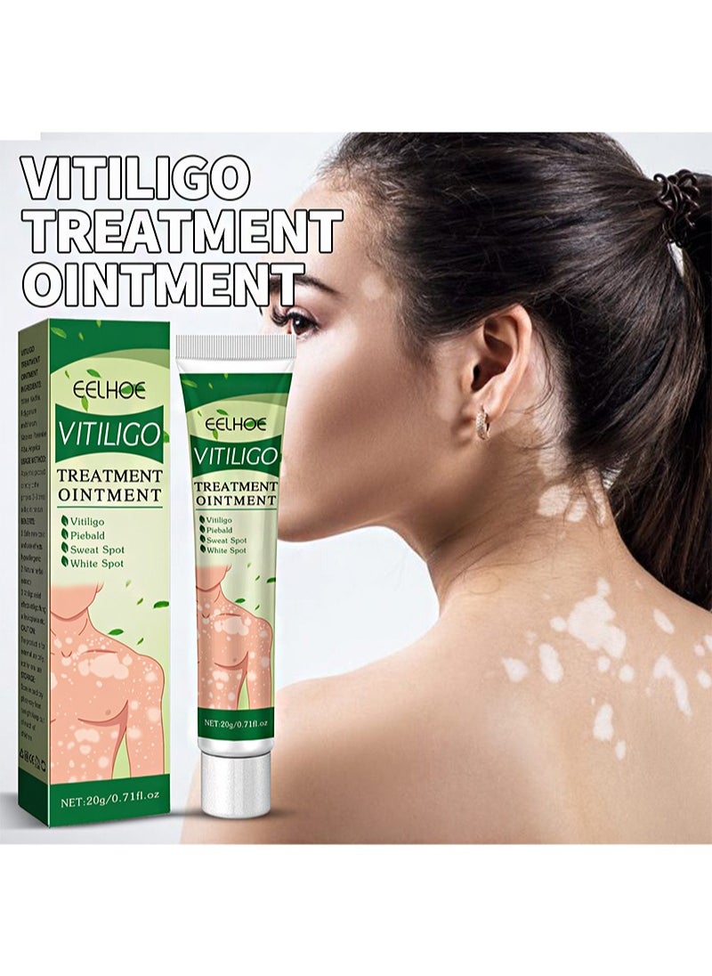 Vitiligo Treatment Ointment，For Psoriasis And Skin Vitiligo, Improve Skin Pigmentation, Reduce White Spots, Vitiligo Care
