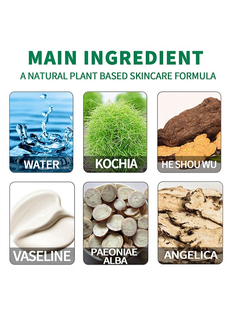 Vitiligo Treatment Ointment，For Psoriasis And Skin Vitiligo, Improve Skin Pigmentation, Reduce White Spots, Vitiligo Care