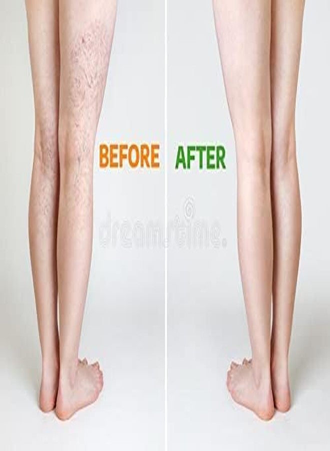TURION Varicose Vein Stockings | Thigh-High Compression Socks for Leg Support | Medical-Grade Graduated Compression for Blood Circulation | Unisex Stretchable & Breathable Support Stockings | Gray Color | (Small-One Pair) - Image 3