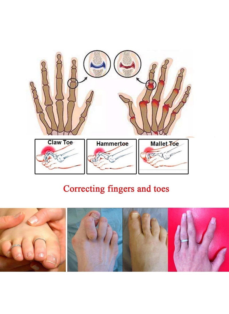 Broken Toe Wraps 15 PCS of Toe Bandages Protectors Hammer Toe Separator Splints Cushioned Corrector Corrector for Overlapping Toes for Broken Toe Hammer Toe Bent Toes (Skin) Medium
