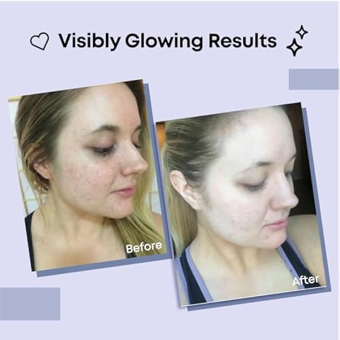 Bayside Collagen Face Mask | Hydrating Beauty Skincare Face Mask for Glass Skin, Revitalizing Overnight Collagen Facial Mask for Wrinkles, Selfcare Sheet, Moisturizing Facial Skin Care Product for Women & Men - Image 2