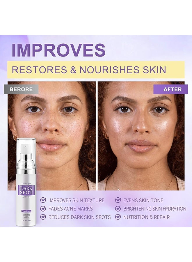 WiRinef Deep Repair Dark Spot Corrector, Dark Spot Remover for Face & Body ,Rapid Tone Repair Cream with Hyperpigmentation Treatment,Sun Spot, Age Spot & Melasma Remover,Dermatologist-Tested Brightening Retinol Serum 50ML - Image 3