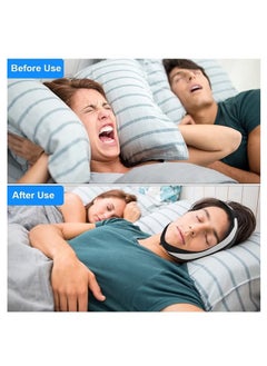 Beauenty Anti Snoring Chin Strap, Comfortable Snoring Reduction Relief Snore Stopper, Breathable Adjustable Stop Snoring Head Band, Good Sleep Anti Snoring Devices - Black  - Image 4