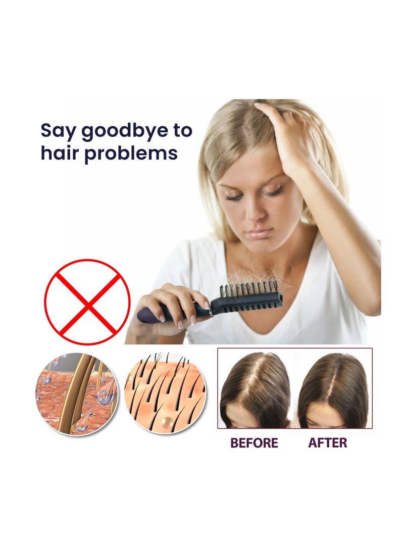 OUHOE Hair Growth Oil Damaged Hair Nourishing Hair growth - Image 2